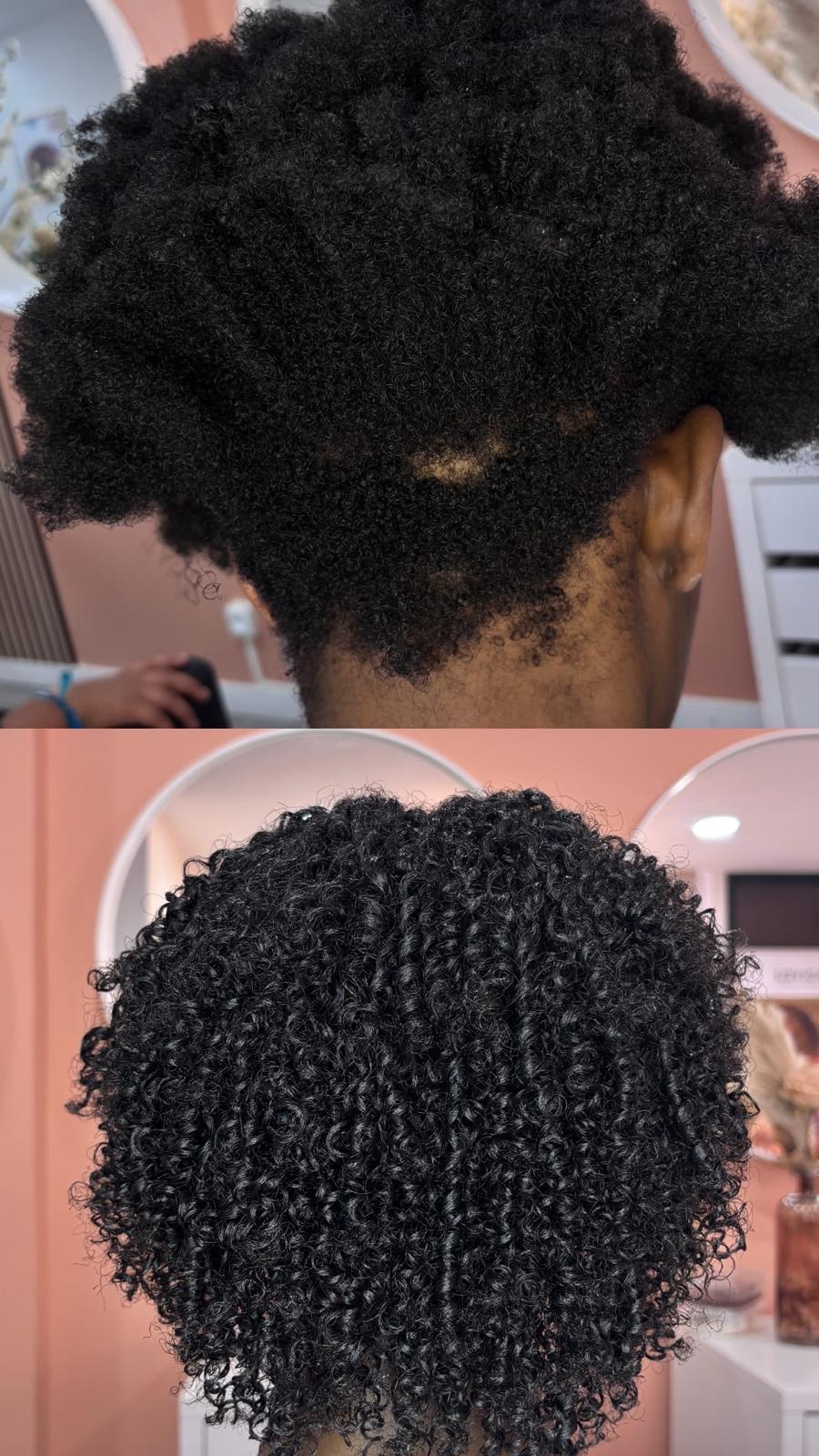 Antes e depois — Marta
